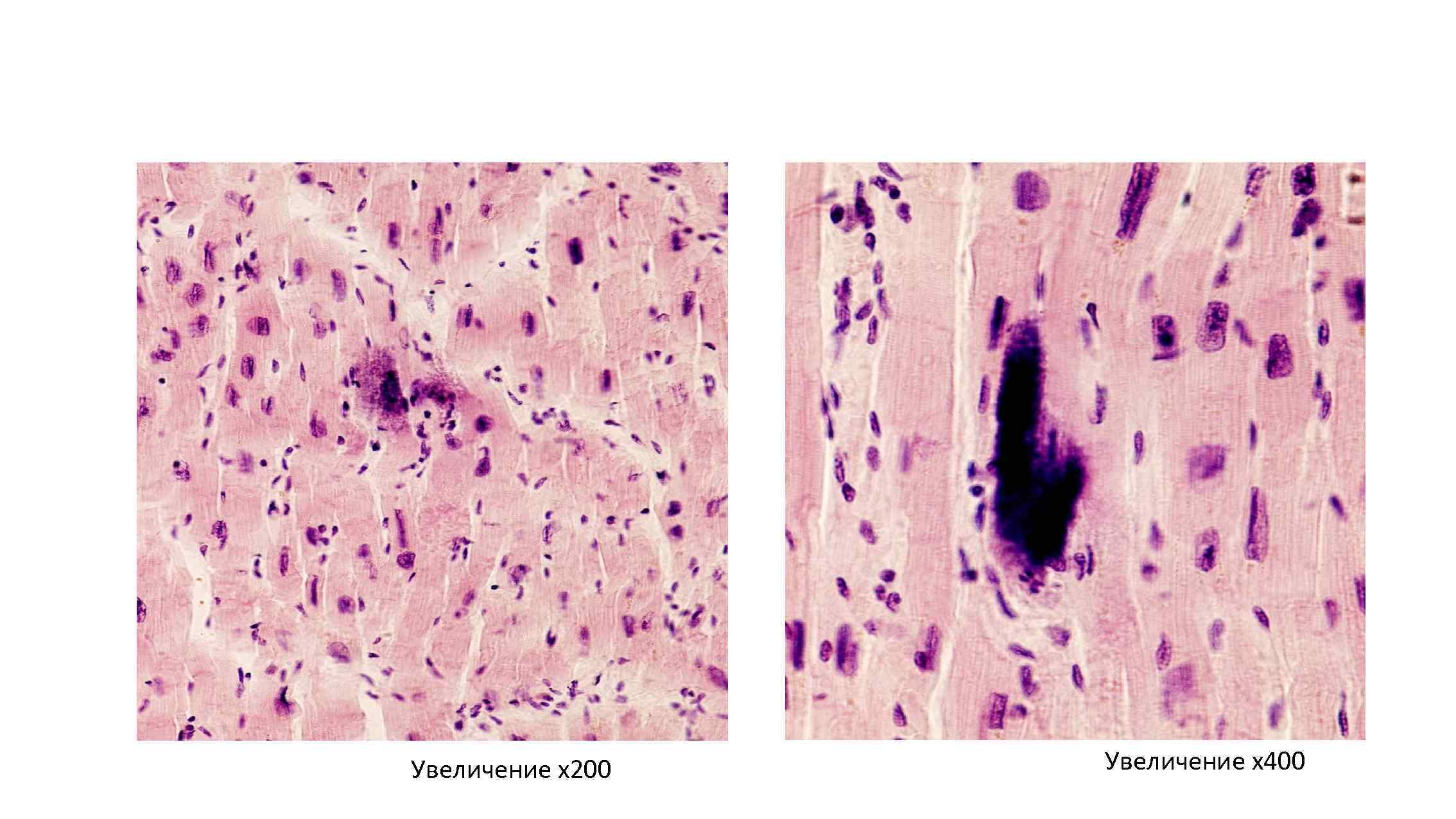 Увеличение х200 Увеличение х400 