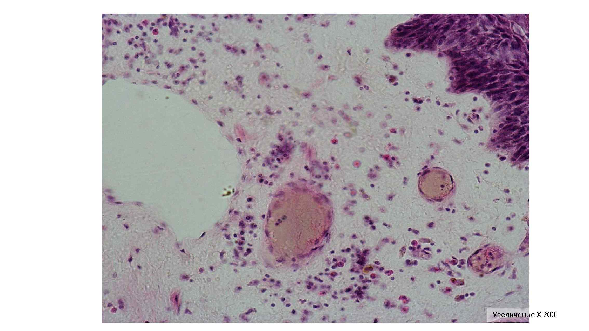 Увеличение Х 200 