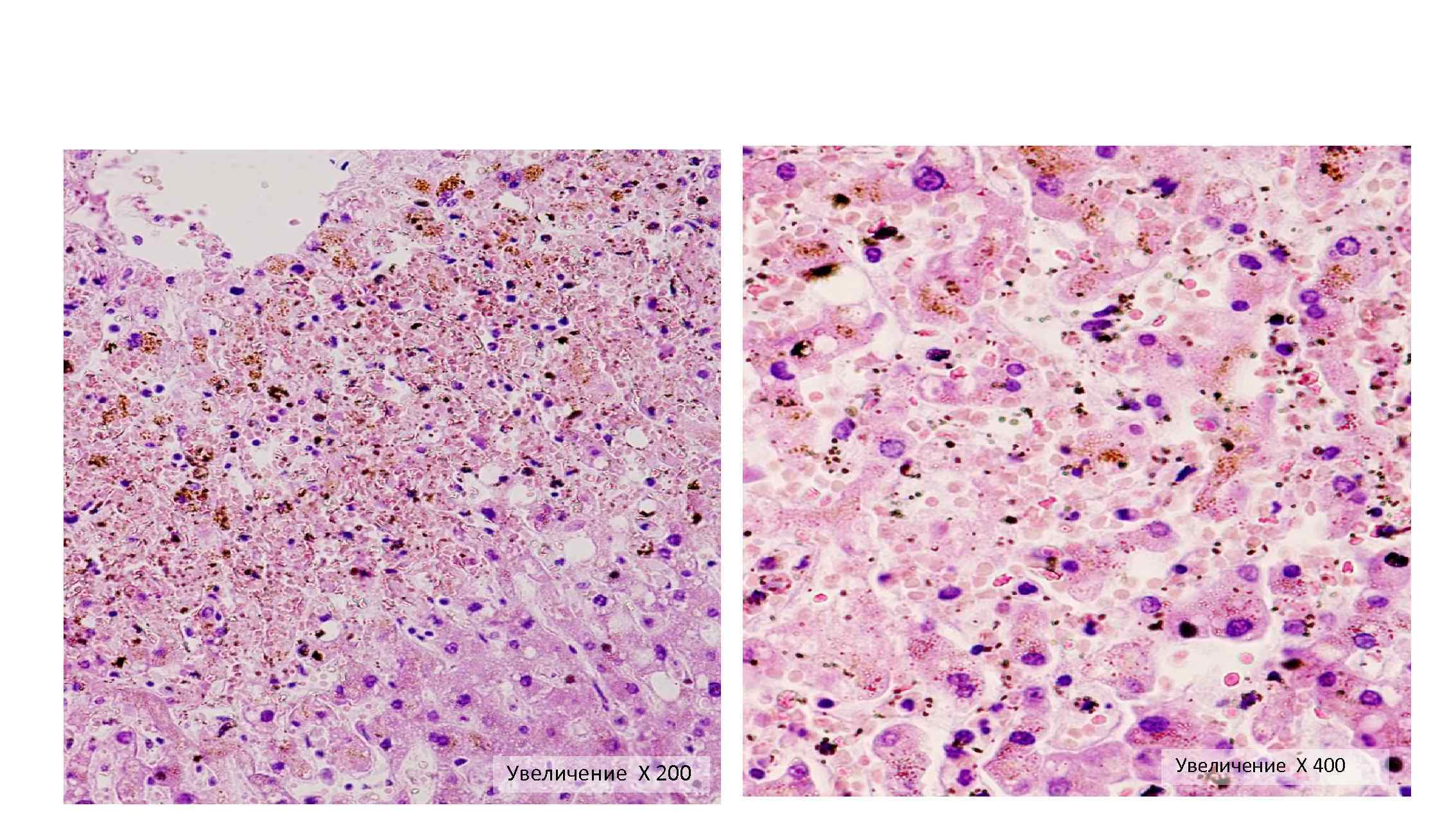  Увеличение Х 200 Увеличение Х 400 