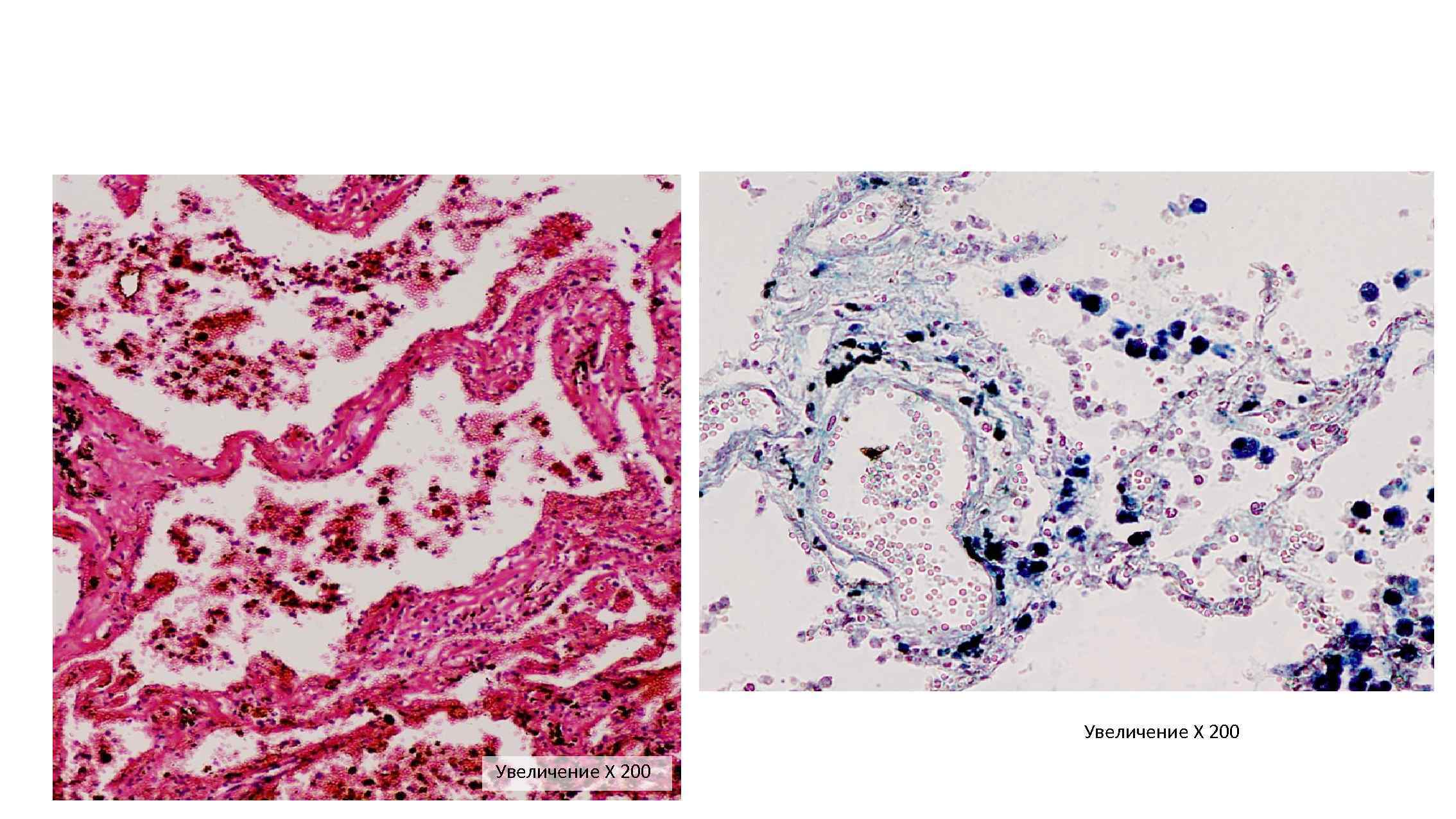 Увеличение Х 200 