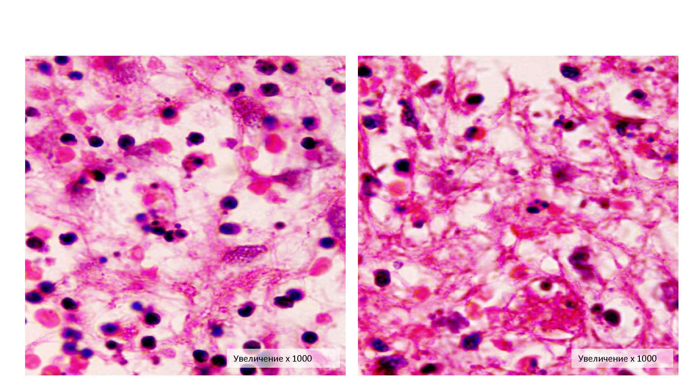 Увеличение х 1000 