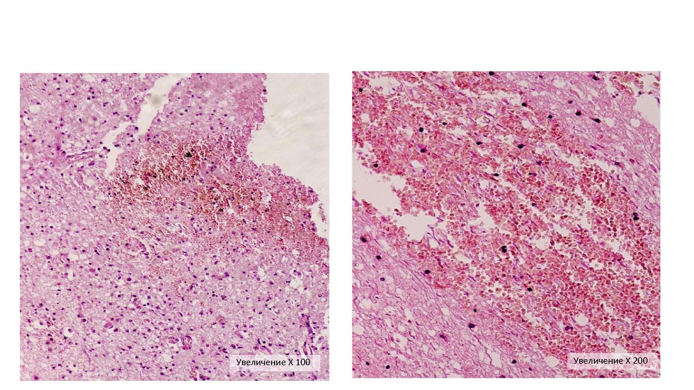 Увеличение Х 100 Увеличение Х 200 