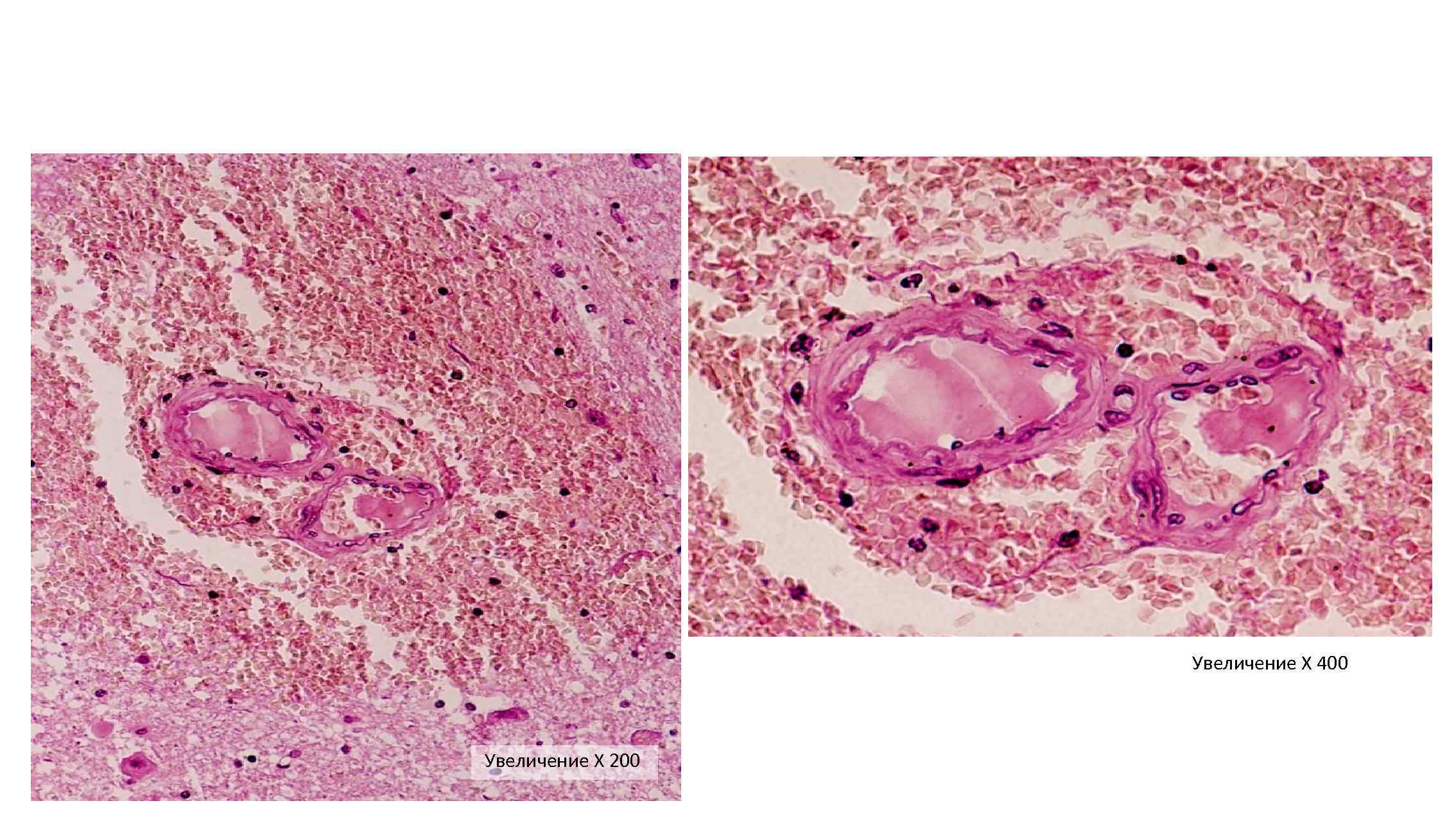 Увеличение Х 400 Увеличение Х 200 