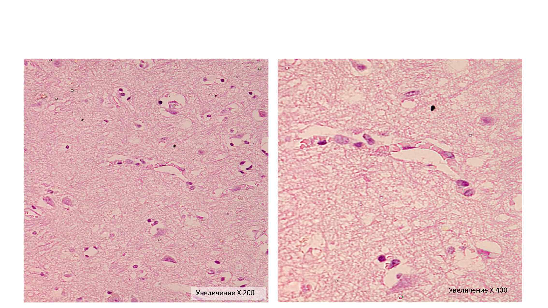 Увеличение Х 200 Увеличение Х 400 