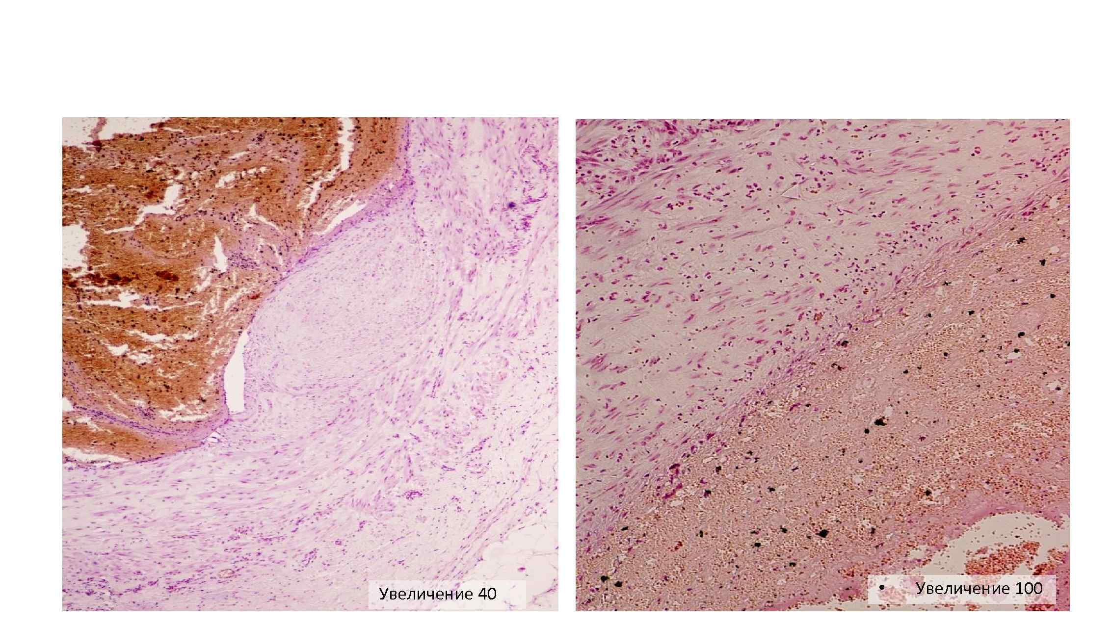 Увеличение 40 • Увеличение 100 