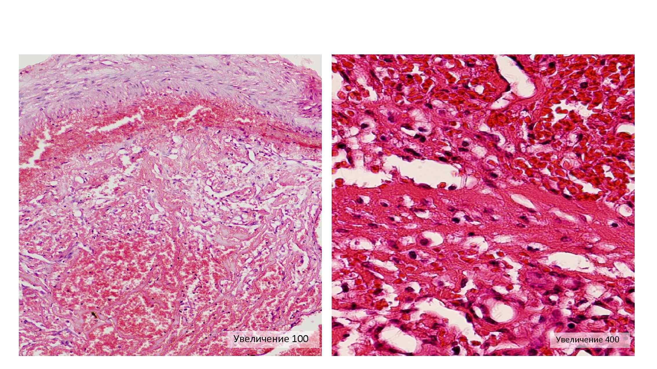 Увеличение 100 Увеличение 400 