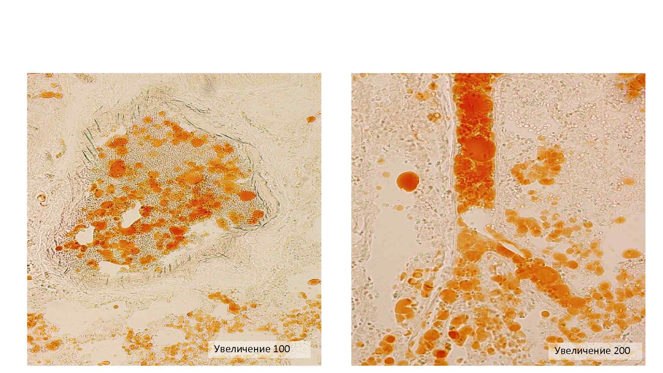 Увеличение 100 Увеличение 200 