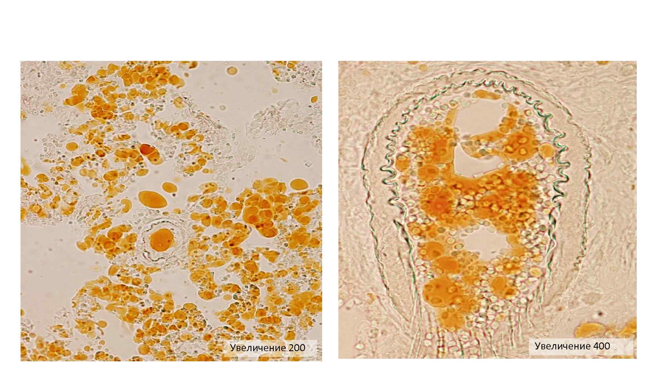 Увеличение 200 Увеличение 400 