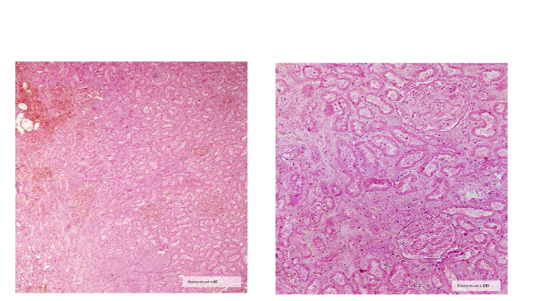 Увеличение х 40 Увеличение х 100 