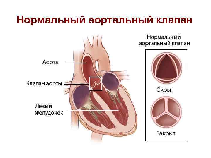 Нормальный аортальный клапан 