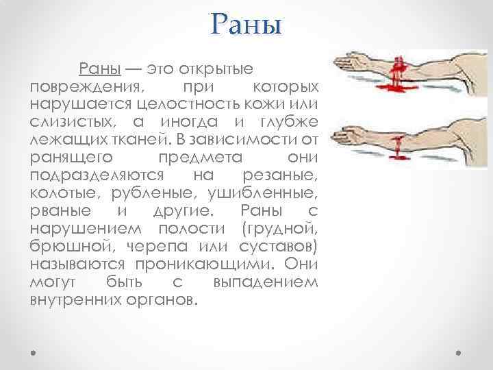 Раны — это открытые повреждения, при которых нарушается целостность кожи или слизистых, а иногда