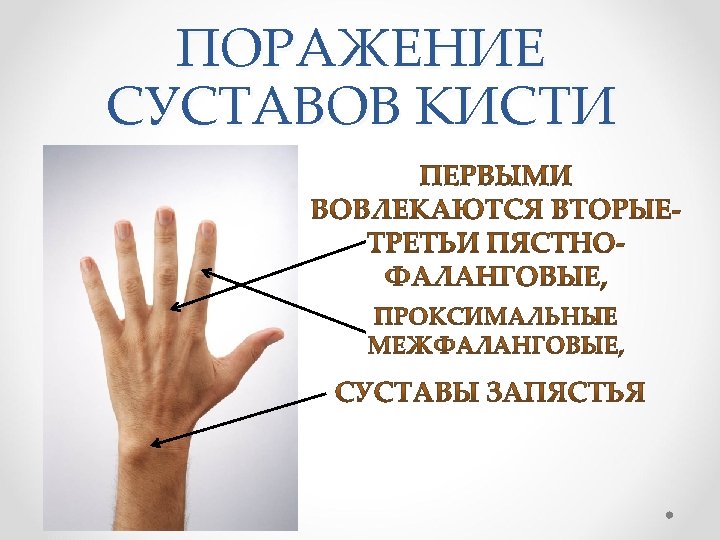 Ревматоидный артрит суставов кистей. Артрит суставов кистей рук мкб 10. Артрит пальцев кисти мкб 10. Код по мкб артрит мелких суставов кистей. Артрит пальца кисти код по мкб 10.