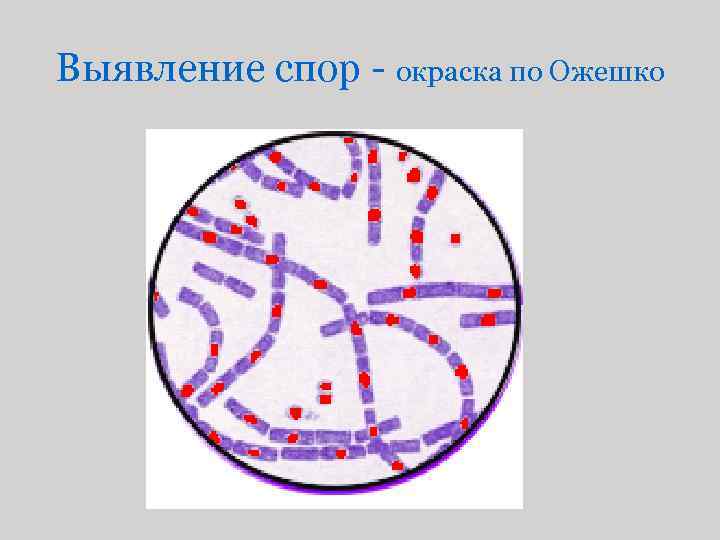 Выявление спор - окраска по Ожешко 