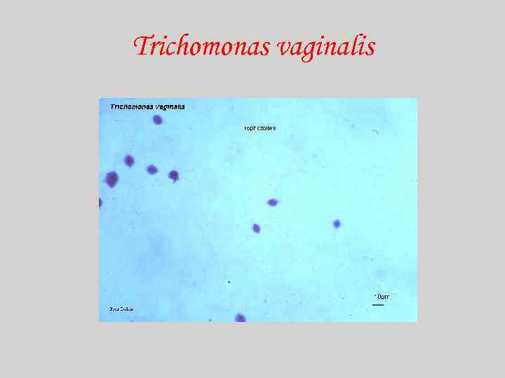 Trichomonas vaginalis 