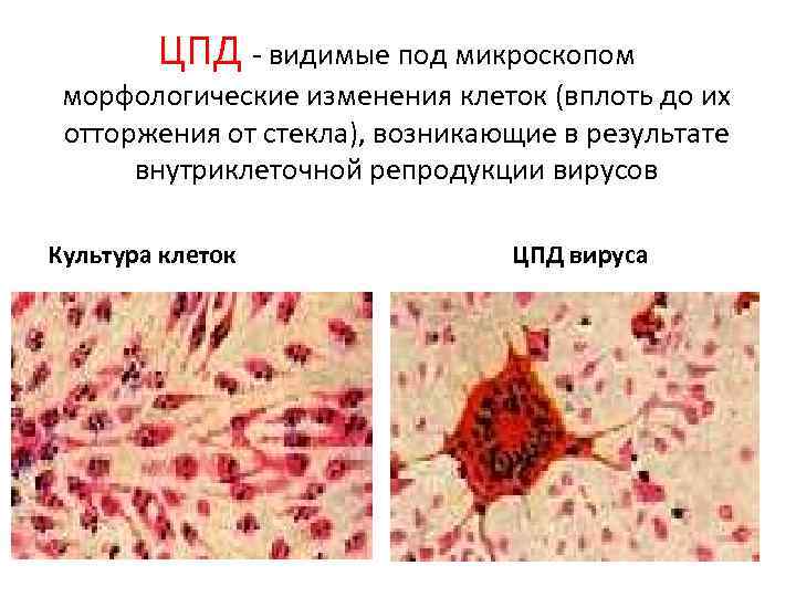 ЦПД - видимые под микроскопом морфологические изменения клеток (вплоть до их отторжения от стекла),