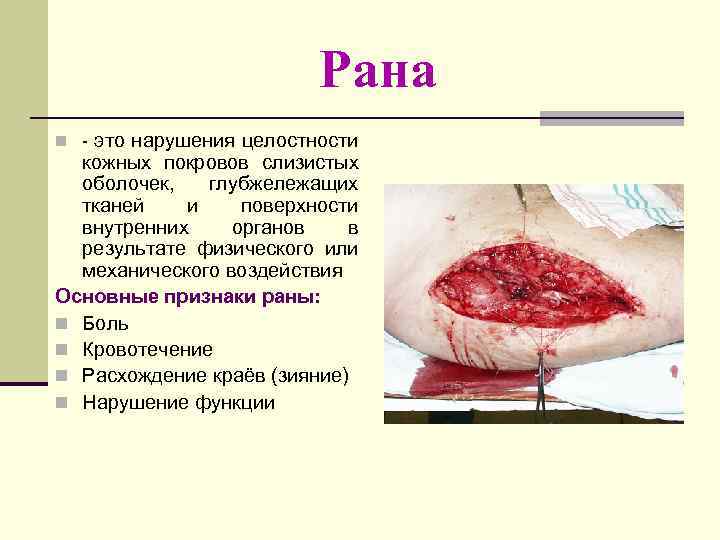 Рана n - это нарушения целостности кожных покровов слизистых оболочек, глубжележащих тканей и поверхности