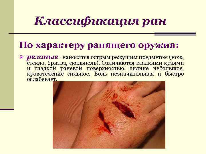 Классификация ран По характеру ранящего оружия: Ø резаные - наносятся острым режущим предметом (нож,