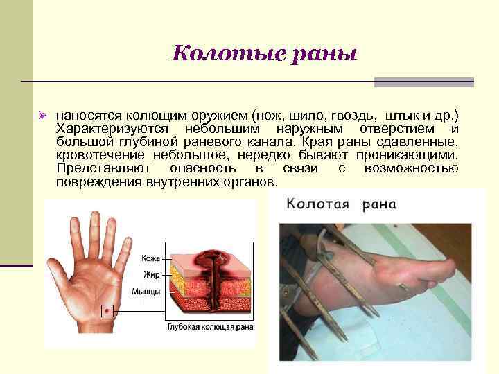 Колотые раны Ø наносятся колющим оружием (нож, шило, гвоздь, штык и др. ) Характеризуются