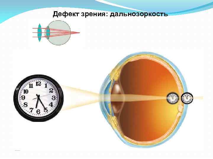 Презентация оптическая система глаза дефекты зрения