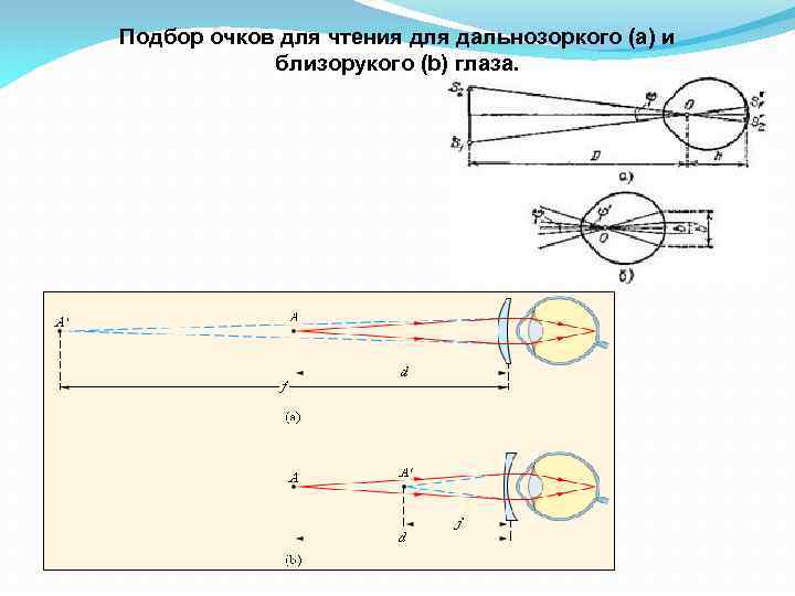 Какие очки носят близорукие и дальнозоркие дать чертежи поясняющие функцию очков