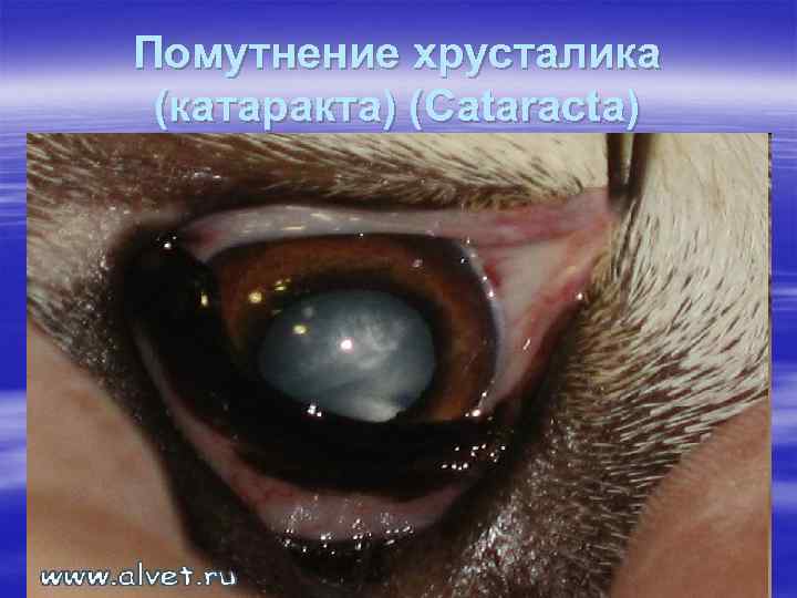 Помутнение хрусталика (катаракта) (Cataracta) 