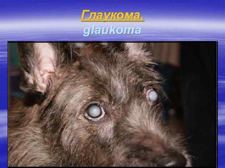 Глаукома. glaukoma 