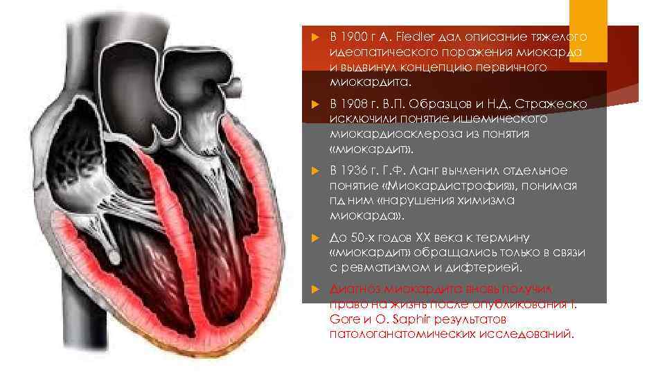  В 1900 г А. Fiedler дал описание тяжелого идеопатического поражения миокарда и выдвинул