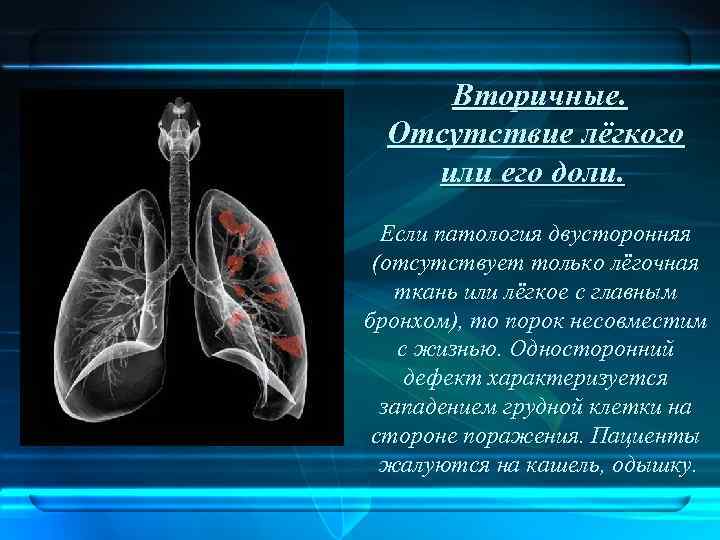 Вторичные. Отсутствие лёгкого или его доли. Если патология двусторонняя (отсутствует только лёгочная ткань или