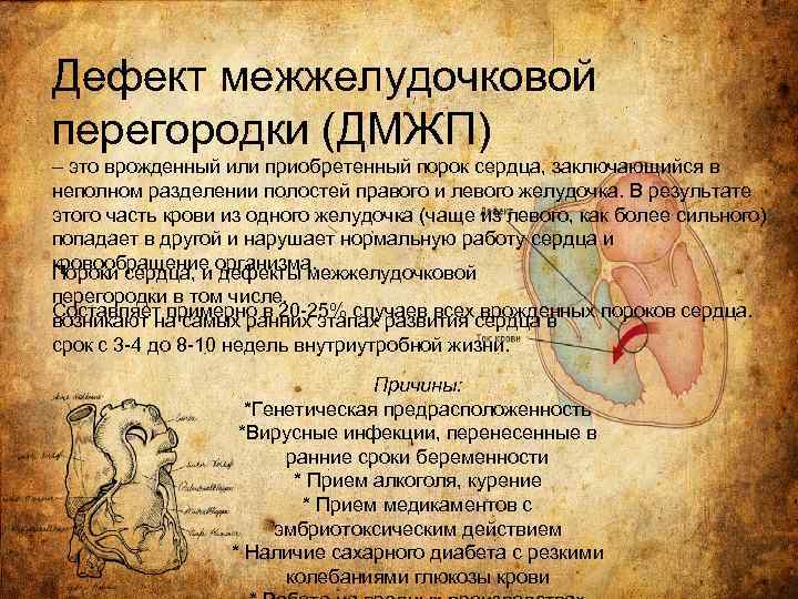 Дефект межжелудочковой перегородки (ДМЖП) – это врожденный или приобретенный порок сердца, заключающийся в неполном