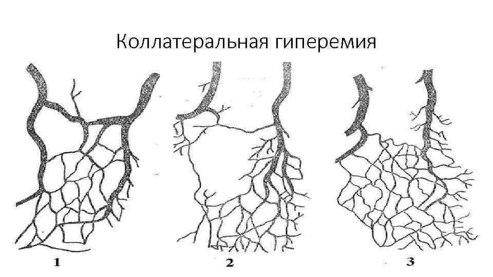 Коллатеральная гиперемия 