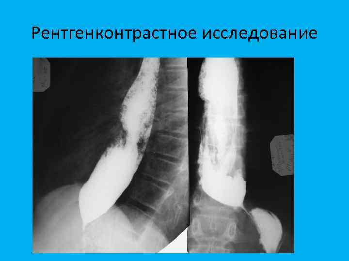 Рентгенконтрастное исследование 