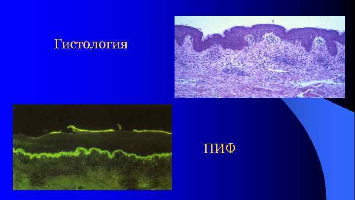 Гистология ПИФ 