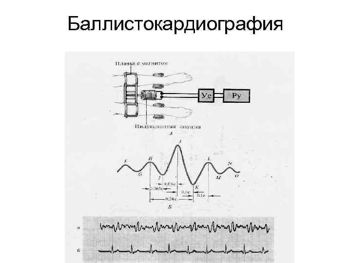 Баллистокардиография 