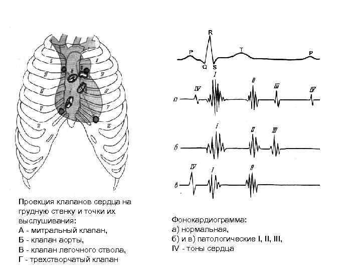 Проекция границ и клапанов сердца на грудную клетку схема