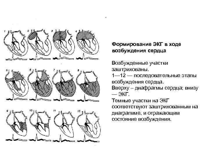 Формирование ЭКГ в ходе возбуждения сердца Возбужденные участки заштрихованы. 1— 12 — последовательные этапы