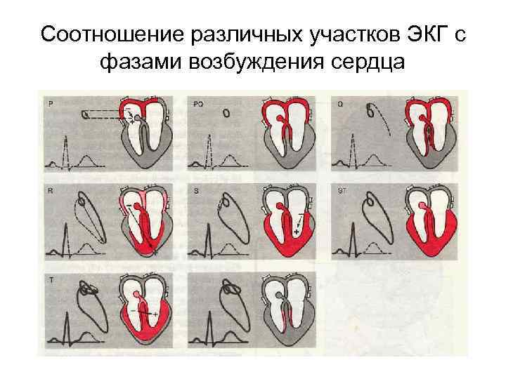 Соотношение различных участков ЭКГ с фазами возбуждения сердца 