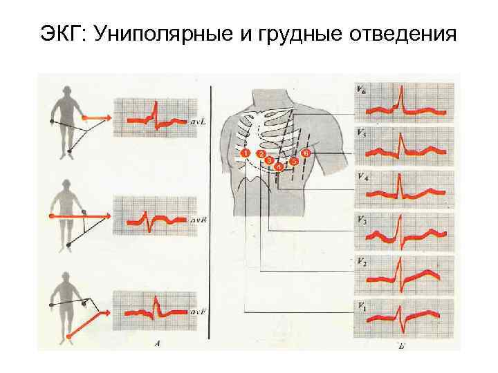 ЭКГ: Униполярные и грудные отведения 