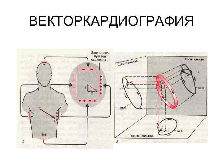 ВЕКТОРКАРДИОГРАФИЯ 