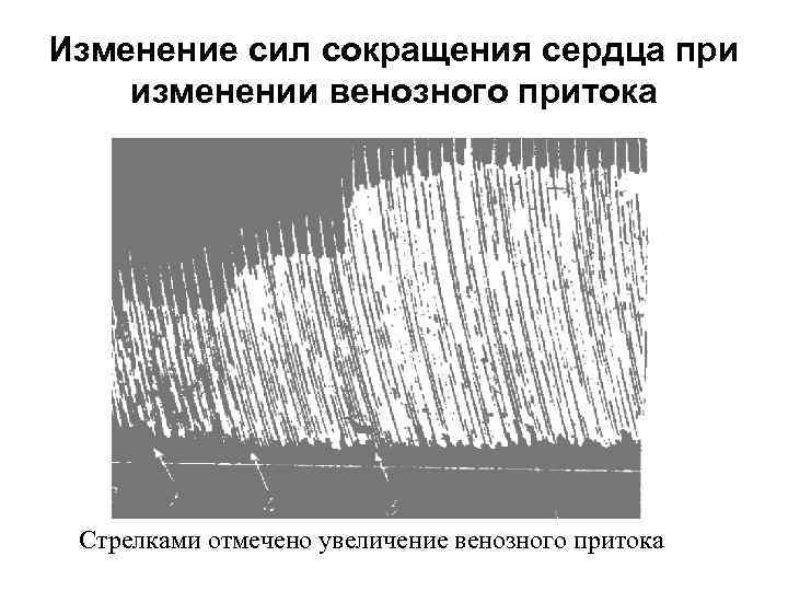 Изменение сил сокращения сердца при изменении венозного притока Стрелками отмечено увеличение венозного притока 