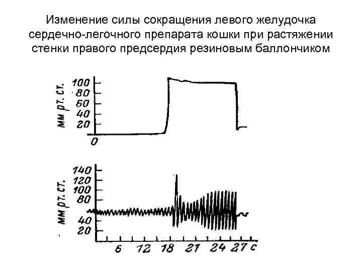 Изменение силы сокращения левого желудочка сердечно-легочного препарата кошки при растяжении стенки правого предсердия резиновым