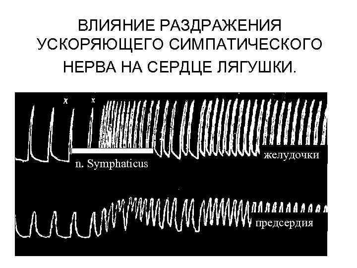 ВЛИЯНИЕ РАЗДРАЖЕНИЯ УСКОРЯЮЩЕГО СИМПАТИЧЕСКОГО НЕРВА НА СЕРДЦЕ ЛЯГУШКИ. n. Symphaticus желудочки предсердия 