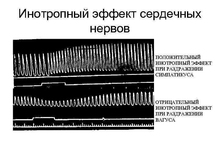 Инотропный эффект сердечных нервов ПОЛОЖИТЕЛЬНЫЙ ИНОТРОПНЫЙ ЭФФЕКТ ПРИ РАЗДРАЖЕНИИ СИМПАТИКУСА ОТРИЦАТЕЛЬНЫЙ ИНОТРОПНЫЙ ЭФФЕКТ ПРИ