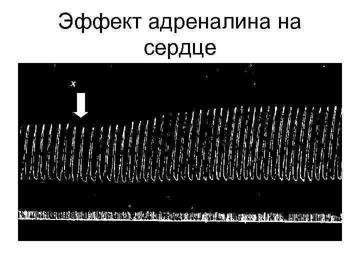 Эффект адреналина на сердце 