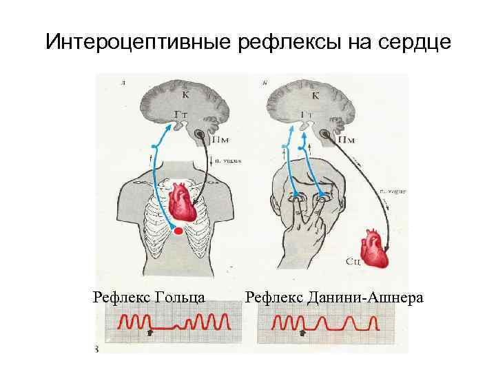 Схема глазосердечного рефлекса