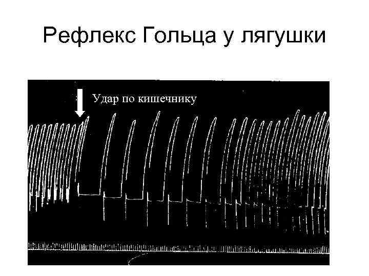 Рефлекс Гольца у лягушки Удар по кишечнику 