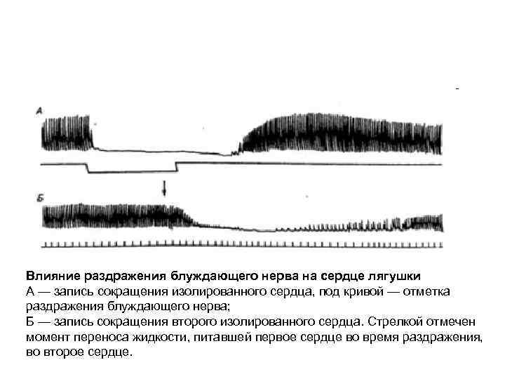 Влияние раздражения блуждающего нерва на сердце лягушки А — запись сокращения изолированного сердца, под