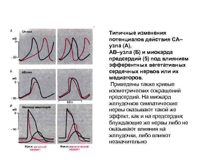 Типичные изменения потенциалов действия СА– узла (А), АВ–узла (Б) и миокарда предсердий (5) под