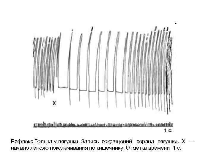 Рефлекс Гольца у лягушки. Запись сокращений сердца лягушки. X — начало легкого поколачивания по