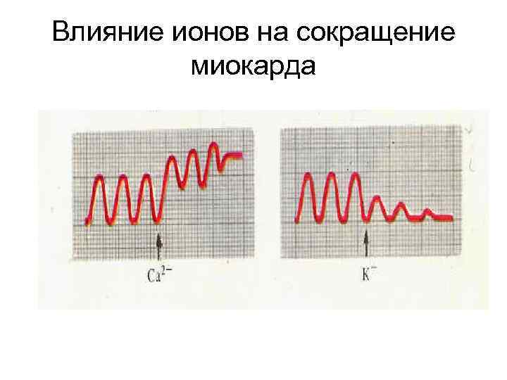 Влияние ионов на сокращение миокарда 