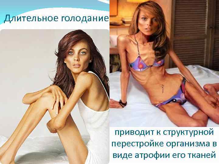 Длительное голодание приводит к структурной перестройке организма в виде атрофии его тканей 